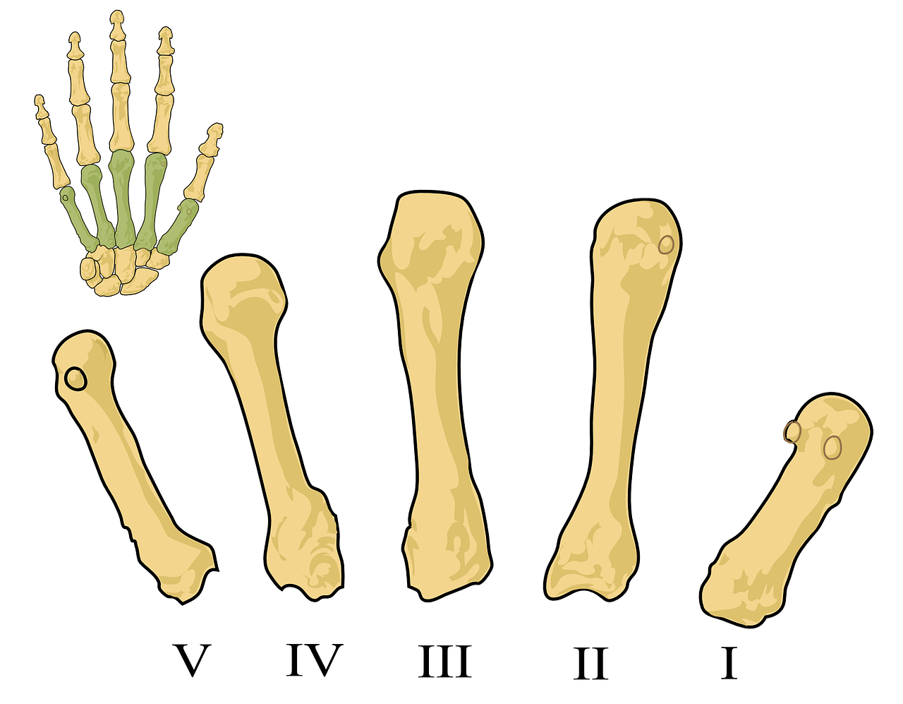 How Does Diet And Nutrition Impact The Development And Management Of Osteoporosis?